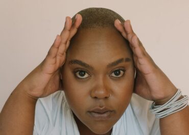 Imagem mulher jovem com alopecia.